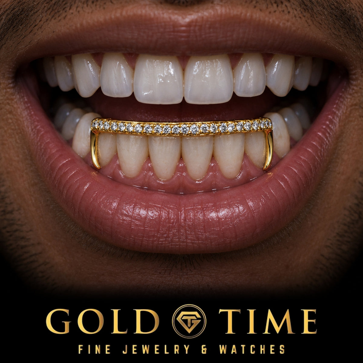 Lower teeth wearing the yellow gold open face hooks grillz with an iced moissanite bar across six teeth and hooks on the canines, Gold Time