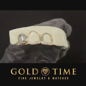 Video of custom silver triple cap grillz with moissanite tips
