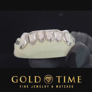 Video of a 6 piece diamond dust grillz set turning to show the box cut texture