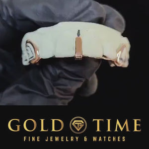 Video of the rose gold open face canines and gap bar grill on the mold