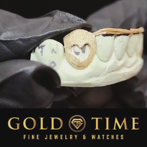 Video of the heart cut out canine grillz with diamond dust tips