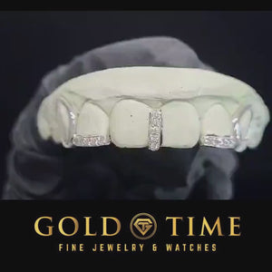 Video of the 5 piece grillz with moissanite gap bar and open face canines turning in the light