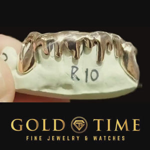 Video of custom silver drip grillz on a dental mold