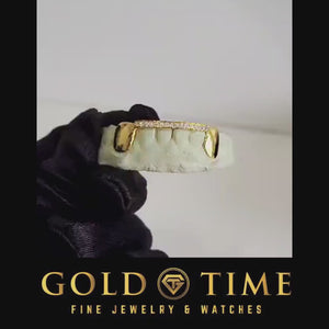 Video of a yellow gold six piece grill with solid canines and a moissanite tip bar, held in a gloved hand