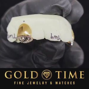 Gloved hand rotating a dental model fitted with a single gold cap with a trillion cut tip