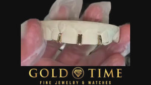 Video of custom 3 gap bar grillz on a dental mold