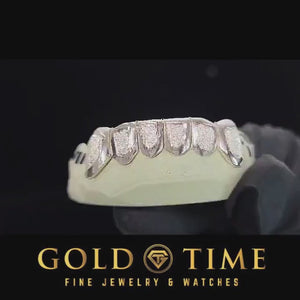 Video of the two-tone 6 piece diamond dust box grill on a dental mold