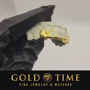 Video of custom 6 piece yellow gold tip bar grillz with open face canines