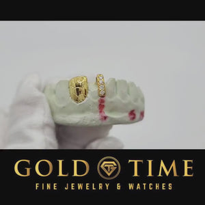 Video of a yellow nugget tooth cap and moissanite gap bar on a dental mold held in a gloved hand