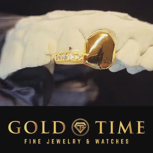 Video of the solid canine and moissanite tip double cap grillz turning on a dental mold